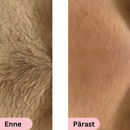 Glowie™ IPL Fotoepilaator – Karvaeemaldusseade