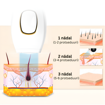 Glowie™ IPL Fotoepilaator – Karvaeemaldusseade