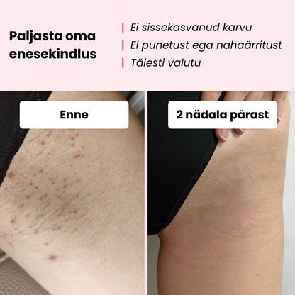 Glowie™ karvaeemalduskomplekt